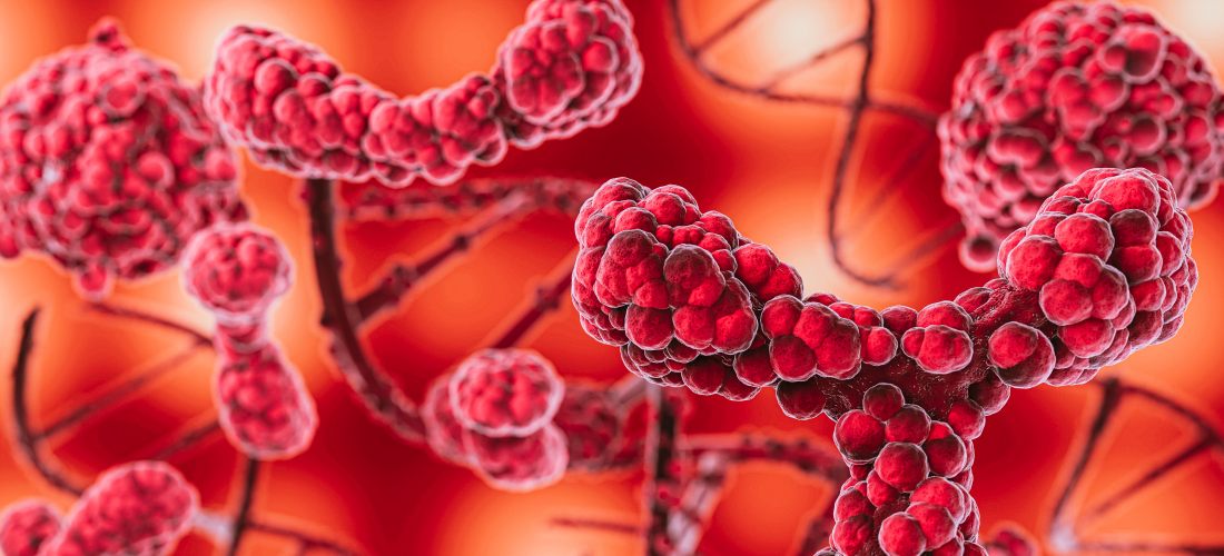 Тромбоз: симптомы и лечение – как не пропустить тревожные сигналы