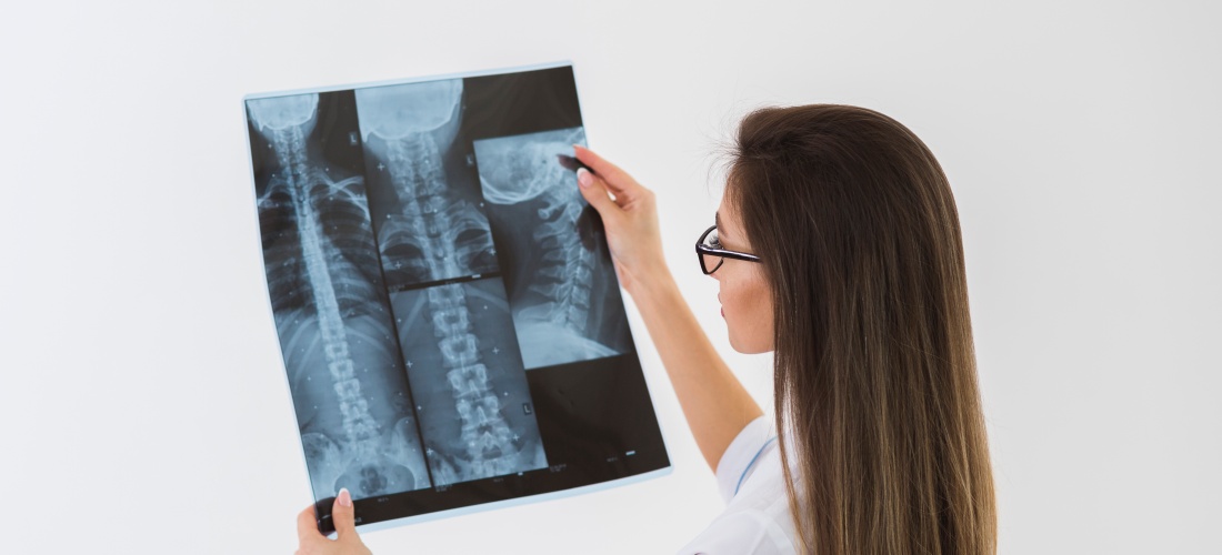 Компрессионный перелом грудного позвонка: причины, симптомы и лечение