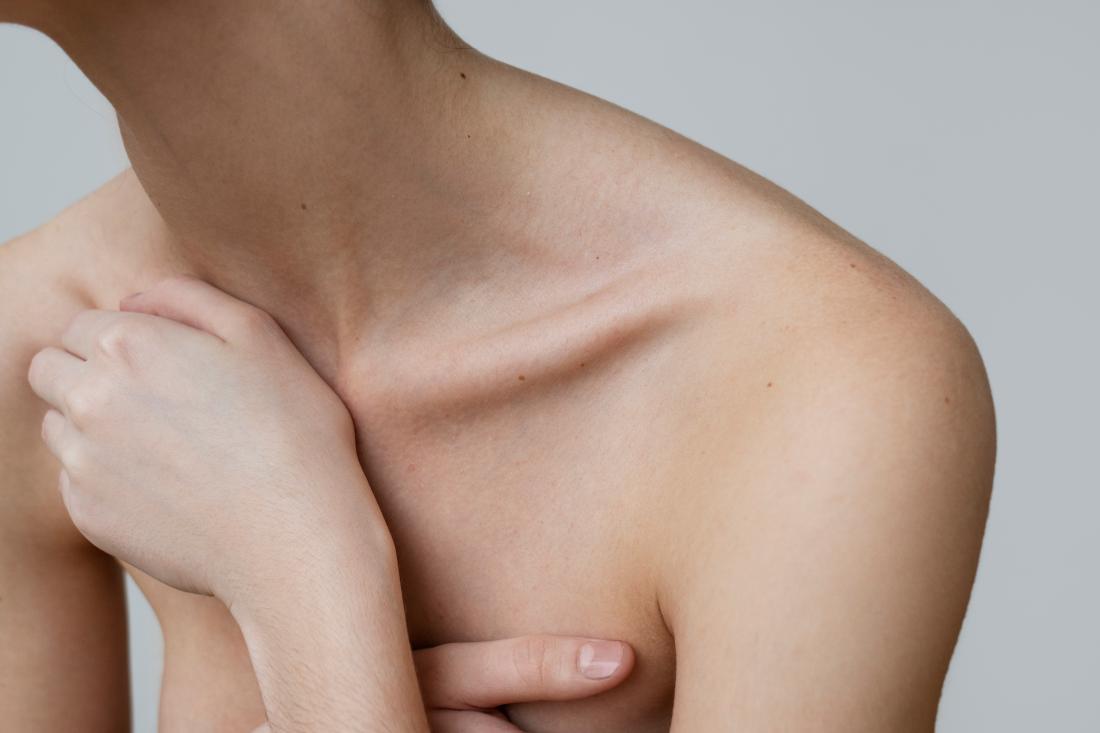 Пучки плечевого сплетения: анатомия, поражения, лечение