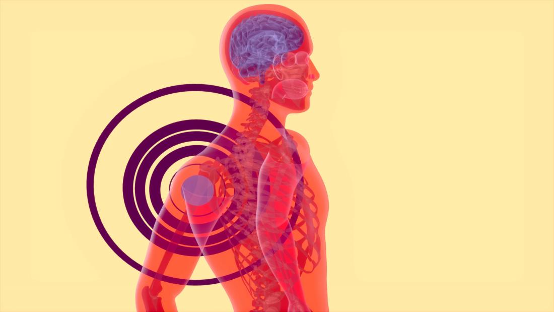 Фасеточный синдром: от диагноза до реабилитации