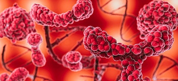 Тромбоз: симптомы и лечение – как не пропустить тревожные сигналы