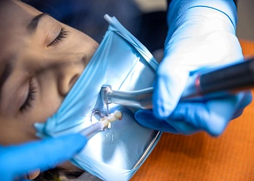 Коффердам в стоматологии: плюсы и минусы использования