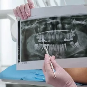Периостит зуба: причины, симптомы, осложнения