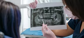 Периостит зуба: причины, симптомы, осложнения