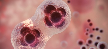 Некроз бедра: симптомы, диагностика, лечение