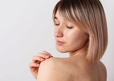 Красные точки как родинки: виды, диагностика, лечение