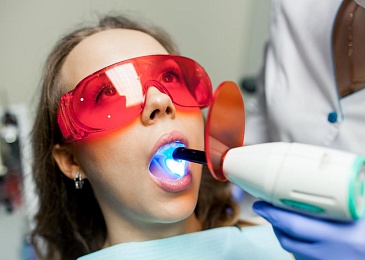 Чистка зубов ультразвуком: показания и этапы