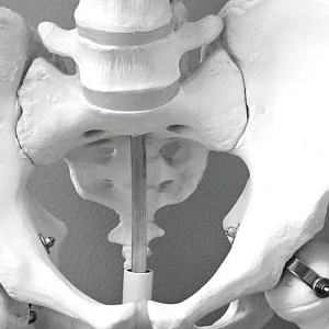 Восстановление после замены сустава: этапы и фазы