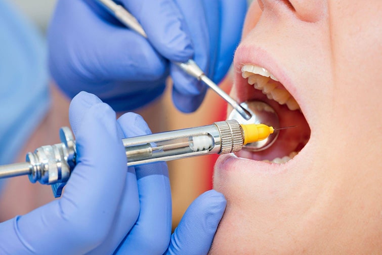 Обезболивающие в стоматологии