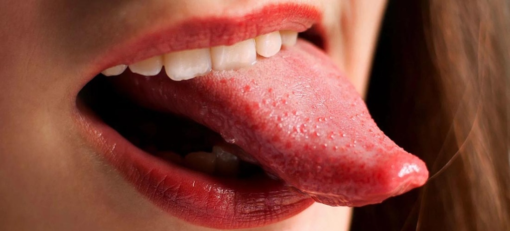 Красные пятна на языке: причины, симптомы, лечение