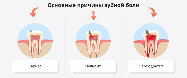 Точки на теле от зубной боли