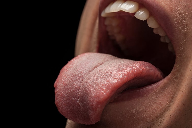 Заболевания слизистой полости рта