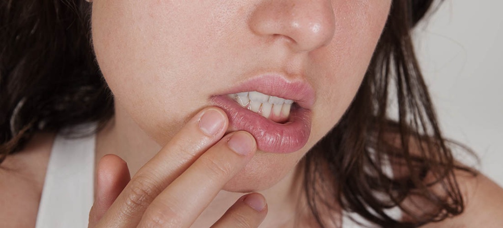 Воспаление во рту: симптомы и лечение