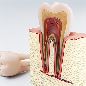 Зуб без нерва: как выглядит, сколько живет, почему болит