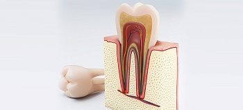 Зуб без нерва: как выглядит, сколько живет, почему болит