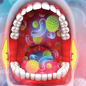 Бактерии во рту: симптомы дисбактериоза и способы лечения