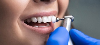 Чистка зубов у стоматолога: показания, этапы и стоимость