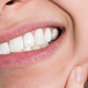 Болят нижние зубы: причины, методы лечения