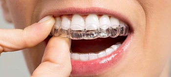 Почему зубы двигаются: причины и лечение